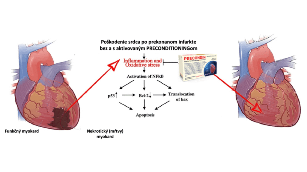 PRECONDIN je cielene určený na ochranu srdcového svalu (myokard) v situáciách, keď je srdce vystavené zvýšenej záťaži alebo nedostatku kyslíka (ischémia).