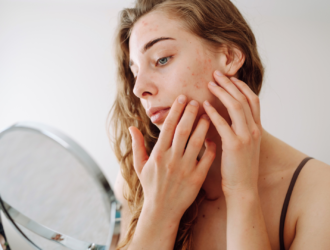 Červené fľaky na lícach, dekolte či nepríjemné svrbenie pokožky sú často vizitkou niečoho, čo sa deje vo vnútri vášho tela.