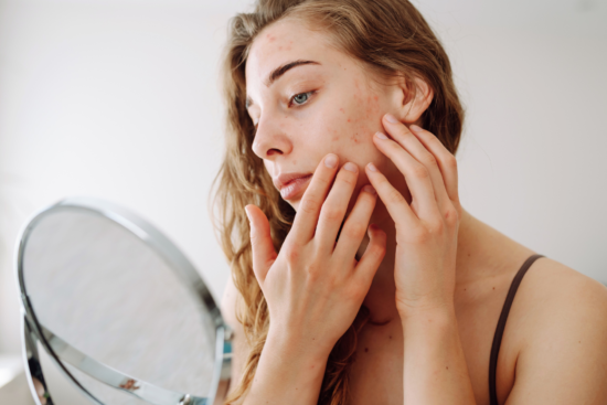 Červené fľaky na lícach, dekolte či nepríjemné svrbenie pokožky sú často vizitkou niečoho, čo sa deje vo vnútri vášho tela.