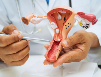 rakovina krčka maternice