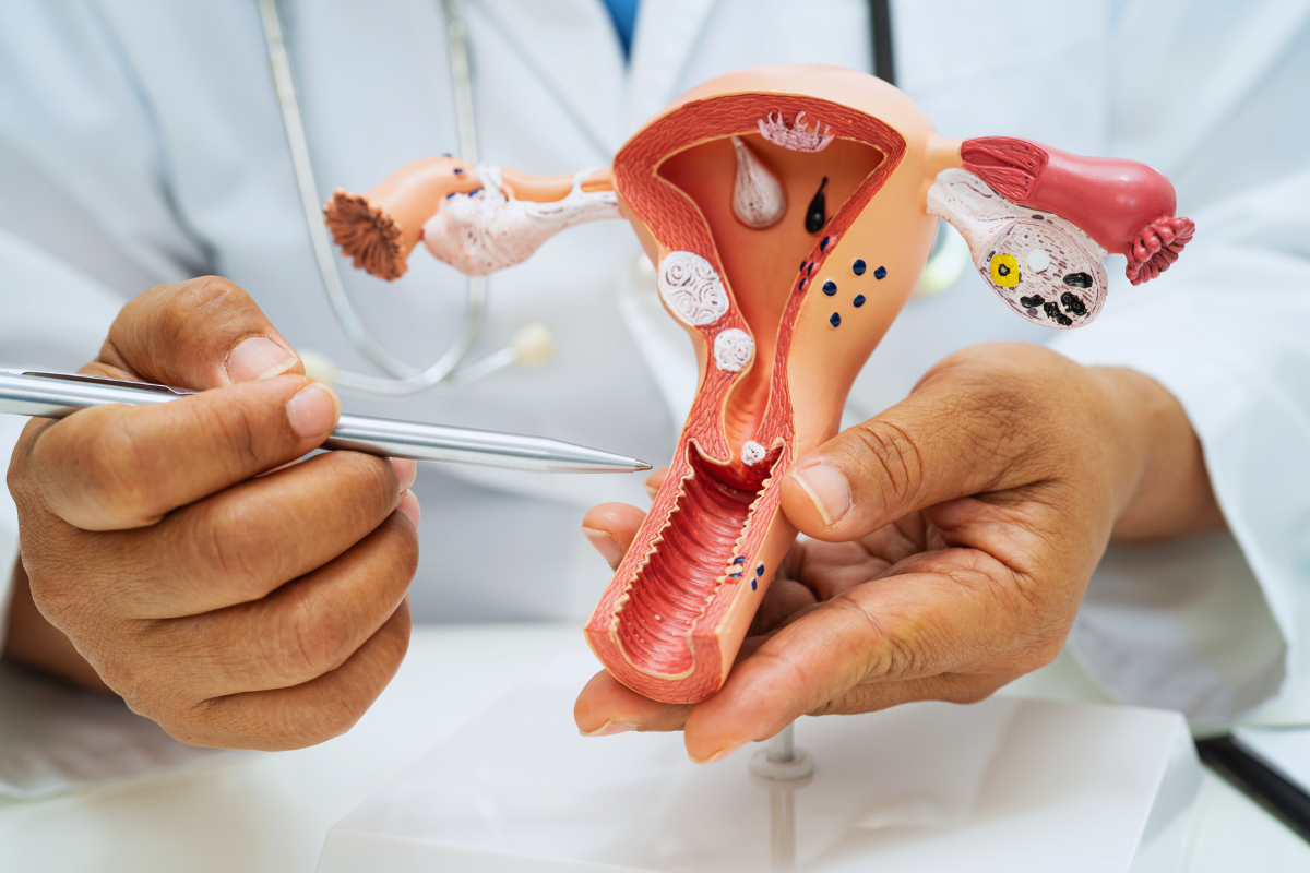 rakovina krčka maternice