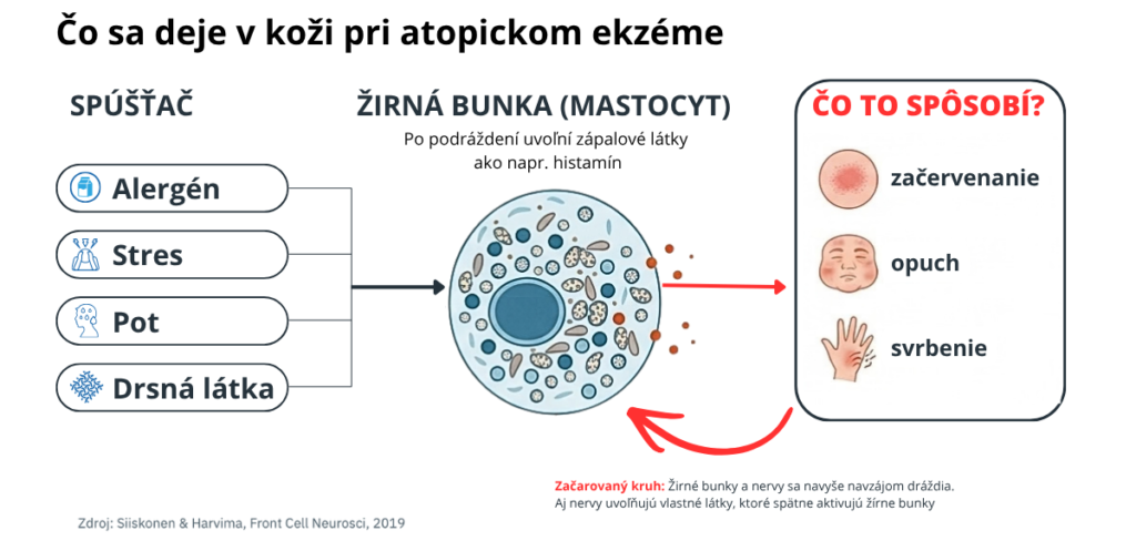 Čo sa deje v koži pri atopickom ekzéme: spúšťač, žírna bunka a začervenanie, opuch a svrbenie